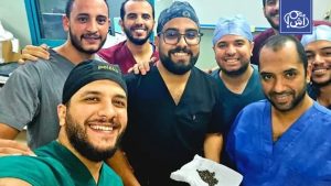 استخراج 58 حصوة من كلية مريض في مصر