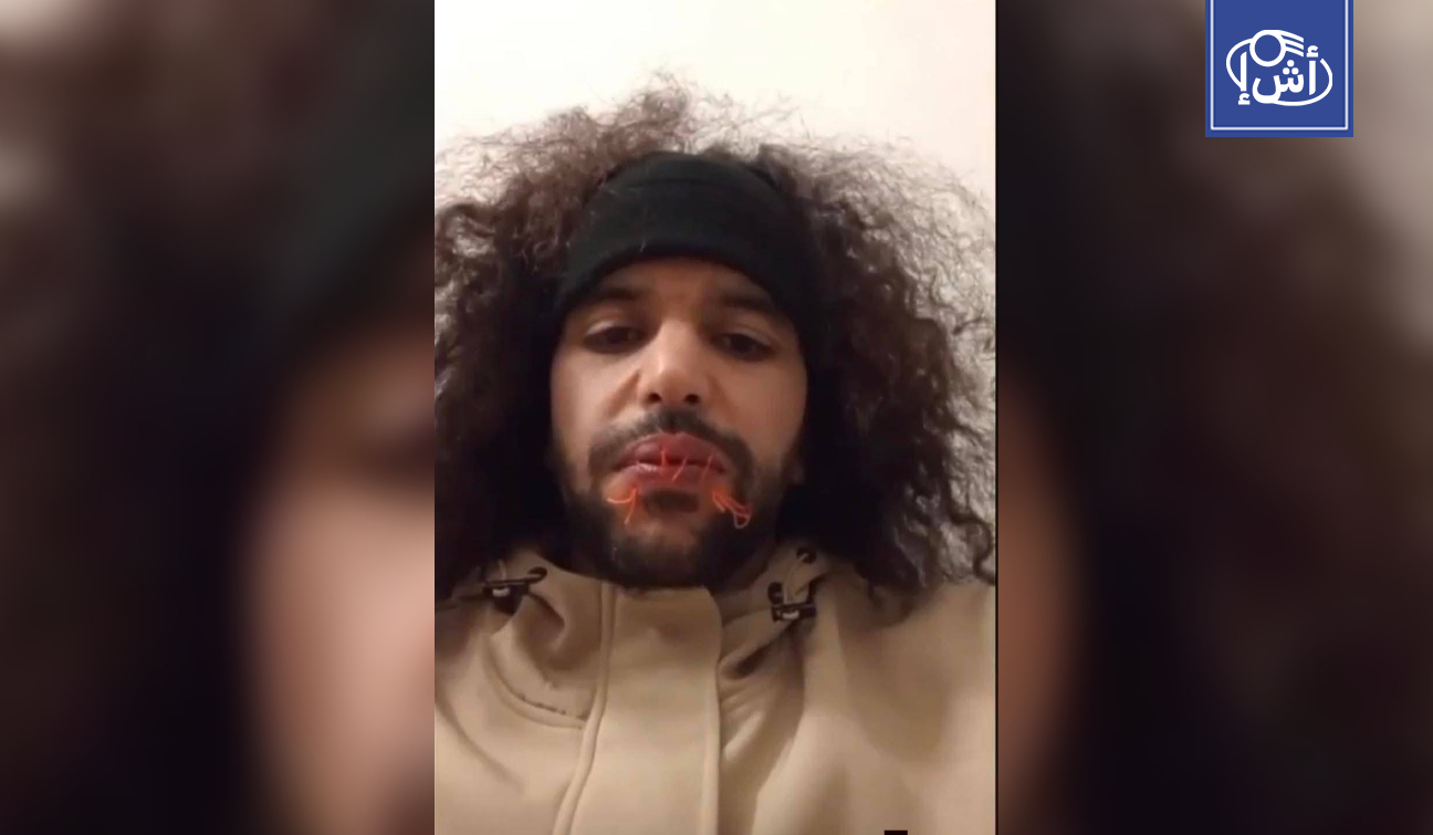 “طفح الكيل”.. سجين ليبي يخيط فمه ويشعل الجدل في إيطاليا